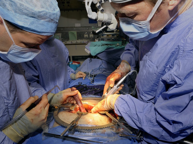 Surgery Still Underused in Early Pancreatic Cancer