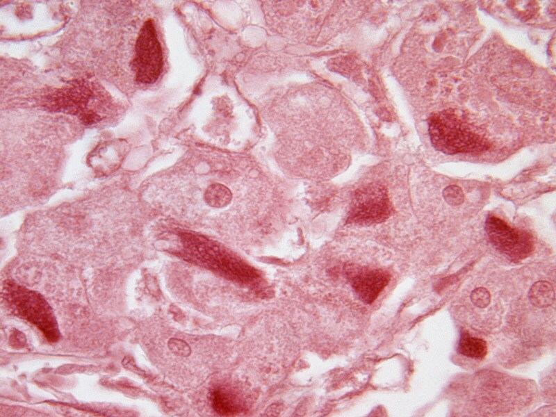 Harga Lamivudine Hepatitis B
