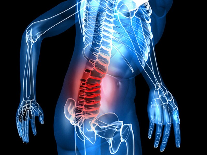Oxycodone/Naloxone an ADF Option for Chronic Low Back Pain