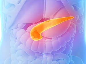TTFields Plus Chemo Shows Benefit in Pancreatic Cancer