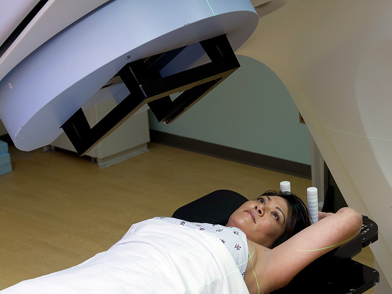 Breast Radiotherapy Not Linked to Cardiac Conduction Problems