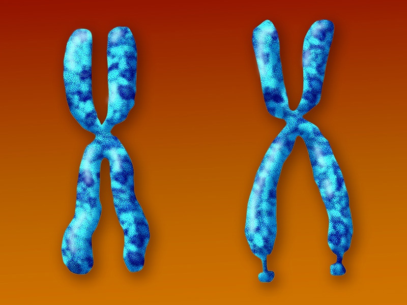 New Test May Risk-Stratify Fragile X Premutation Carriers