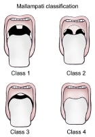 Pediatric Sedation