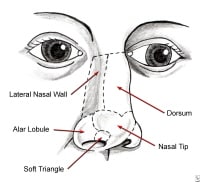 Principles and Techniques of Nasal Reconstruction: Overview ...