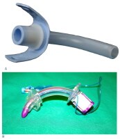 Tracheostomy