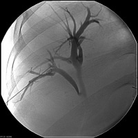 Cholangiography