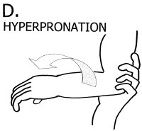 Radial Head Subluxation Joint Reduction Technique