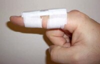 Finger Dislocation Joint Reduction