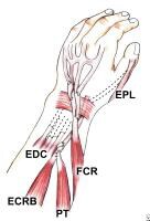 Tendon Transfer Principles and Mechanics: Overview, Technique