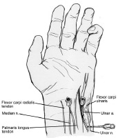 Ulnar Nerve Block Technique: Approach Considerations, Above the Elbow ...