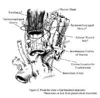 Tracheostomy