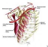 Latissimus Myocutaneous Flap: Overview, Anatomy, Contraindications