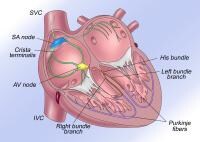 Pediatric Pacemaker Implantation