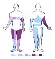 Acrodermatitis Chronica Atrophicans Clinical Presentation: History ...