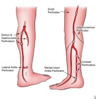 Venous Insufficiency: Background, Anatomy, Pathophysiology