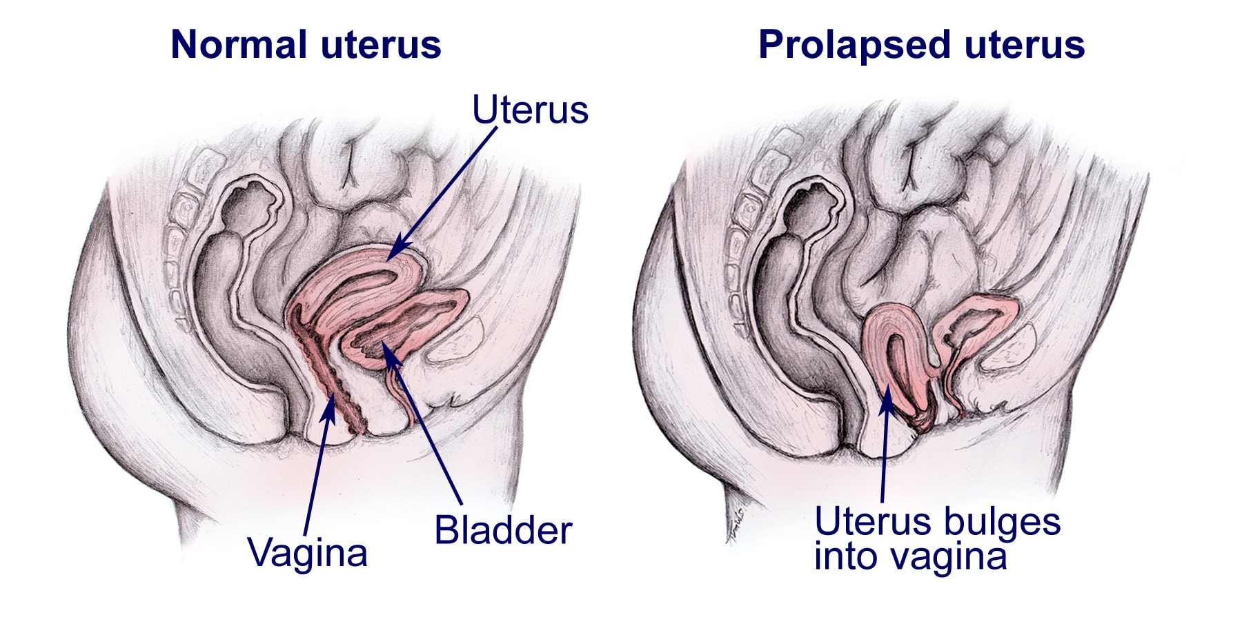 Why You're Having Painful Sex During Pregnancy