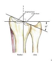 Distal-Third Forearm Fractures Workup