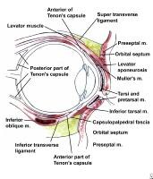 Ectropion Lower Eyelid Reconstruction