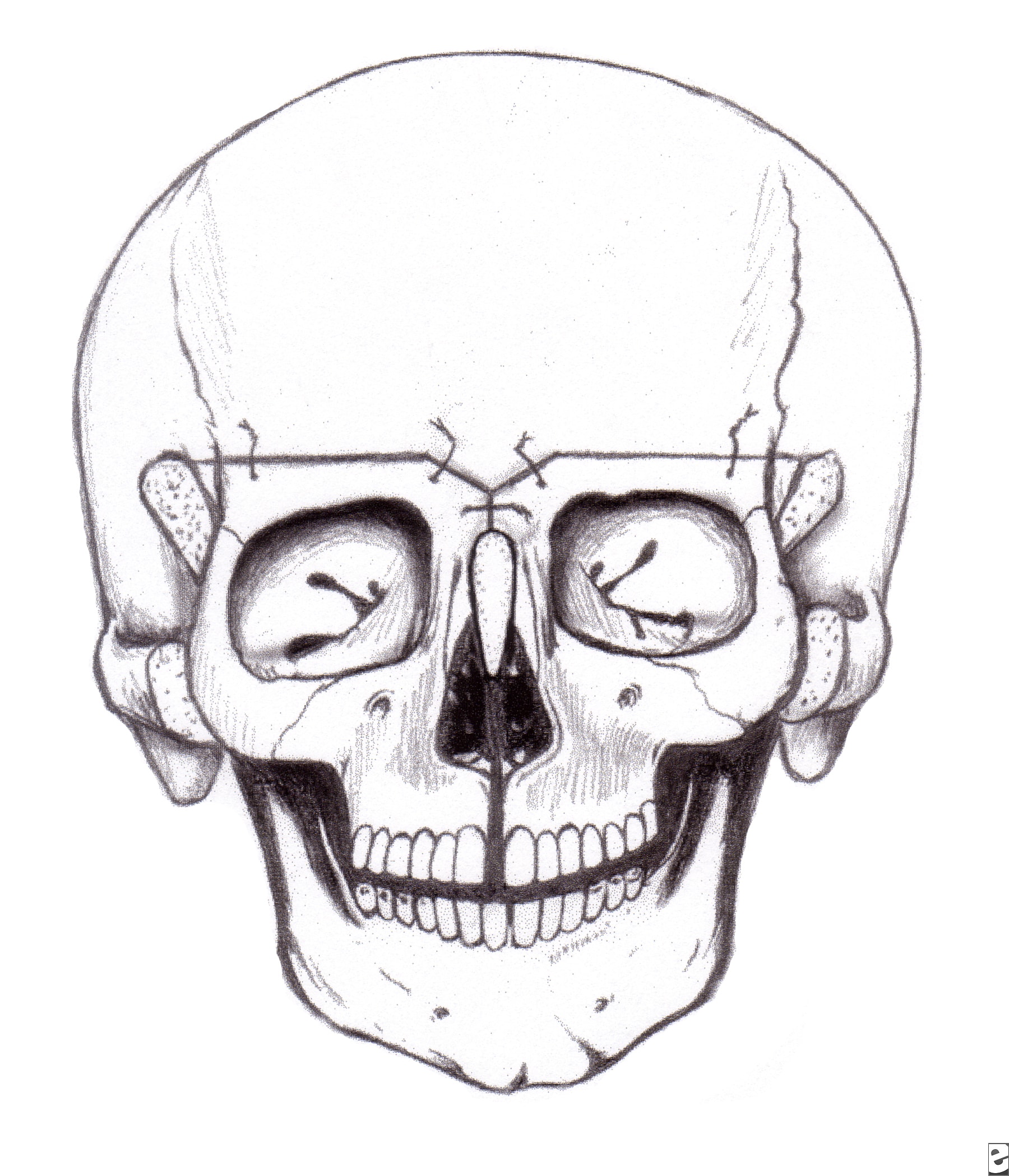 Secondary bone grafting in alveolar clefts thesis
