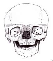 Hypertelorism. Diagram of osteotomies to be perfor