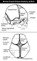 Congenital Synostoses: Overview, Embryology and Development, Pathogenesis