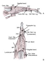 Extensor Tendon Lacerations: Background, History Of The Procedure ...