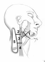 Head and Neck Cancer - Resection and Neck Dissection