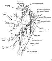 Prominent Ear: Background, History of the Procedure, Problem