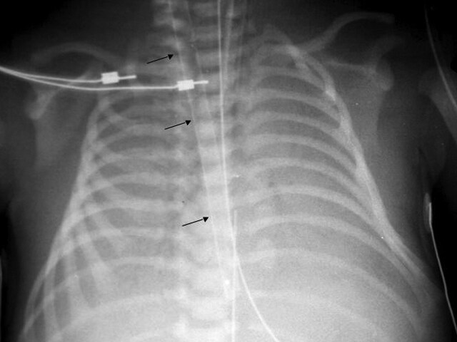 Meconium - JungleKey.fr Image