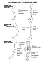 Acute Poliomyelitis Treatment & Management