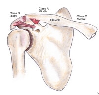 Clavicular Injuries ~ Sports Medicine