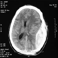 Initial Evaluation of the Trauma Patient