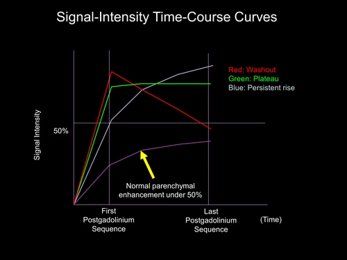 Time-signal intensity curve for breast lesions. A type I curve shows