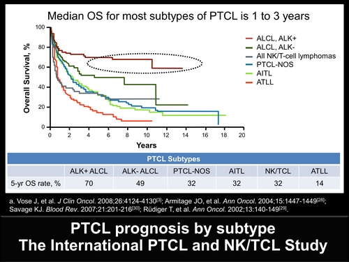 A Pathologists Guide To The Accurate Diagnosis Of Peripheral T Cell Lymphomas 