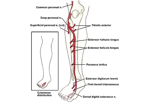 Peroneal Neuropathies; Neuropathy, Common Peroneal; Neuropathy, Deep ...