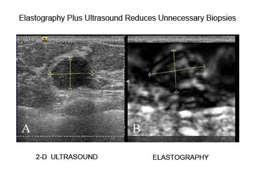 Radiological Society of North America (RSNA) 2009 Annual Meeting: Slideshow