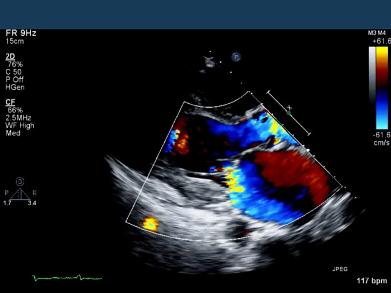 who-needs-an-ecg