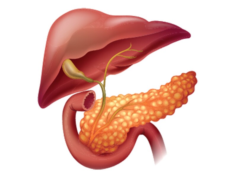 Complicated Intra-abdominal Infections and Multidrug-Resistant Organisms