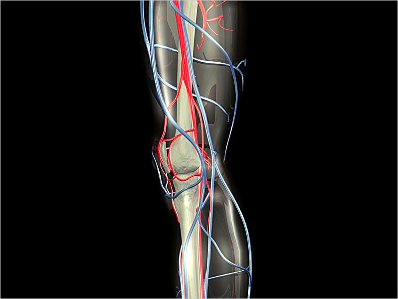 Addressing Current Treatment of PAD: Test Your Knowledge