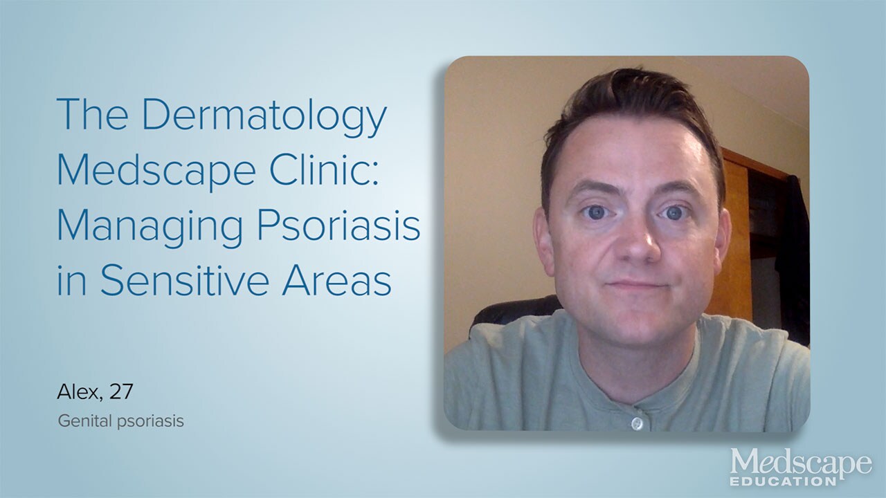 The Dermatology Medscape Clinic: Managing Psoriasis in Sensitive Areas ...