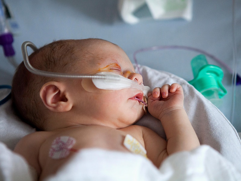 does-high-flow-cannula-oxygen-improve-bronchiolitis-outcomes