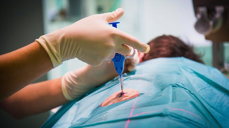 New RBI For Kidney Allografts Can It Replace Routine Tests 