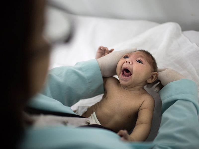 Cdc Aap Update Recs For Infants And Congenital Zika Virus 