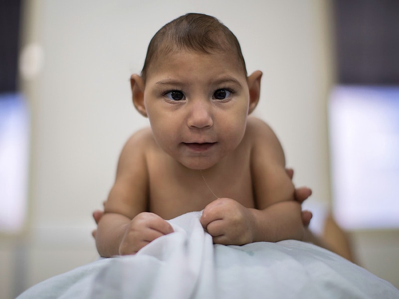 Children With Congenital Zika Need Long-term Follow-up Care