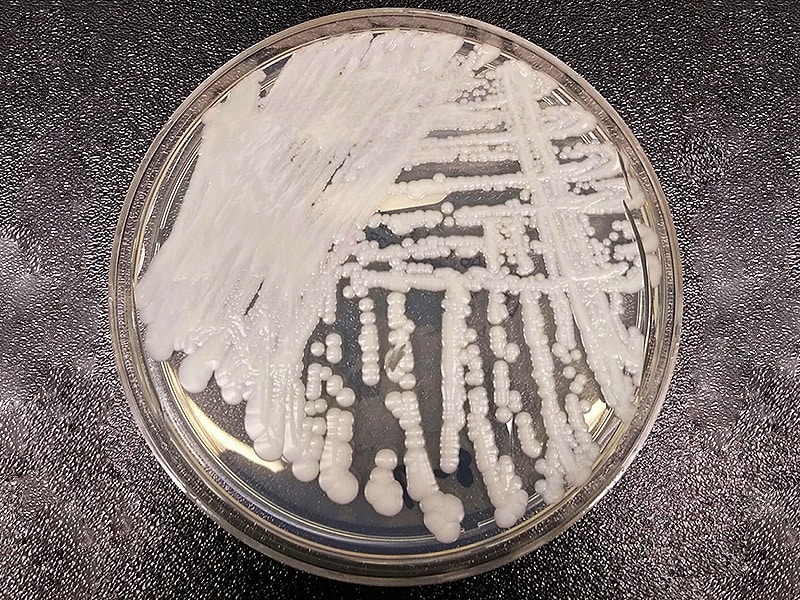 candida auris cdc guidelines