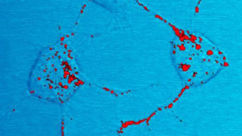 Detection of Prions in a Cadaver for Anatomical Practice