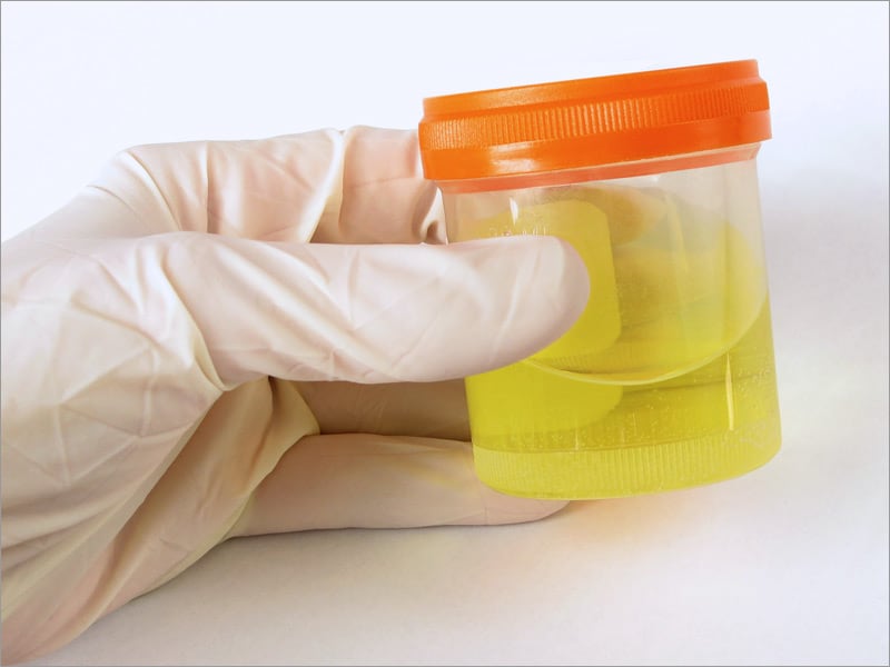 Urine Testing Of Prescribed Psychotropics In Addicts Warranted 8889
