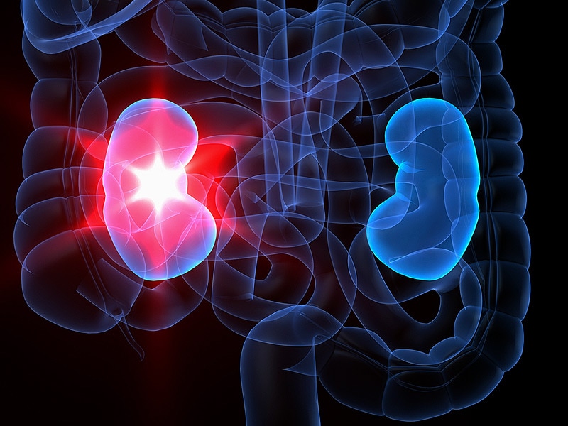 what-is-causing-this-acute-renal-failure