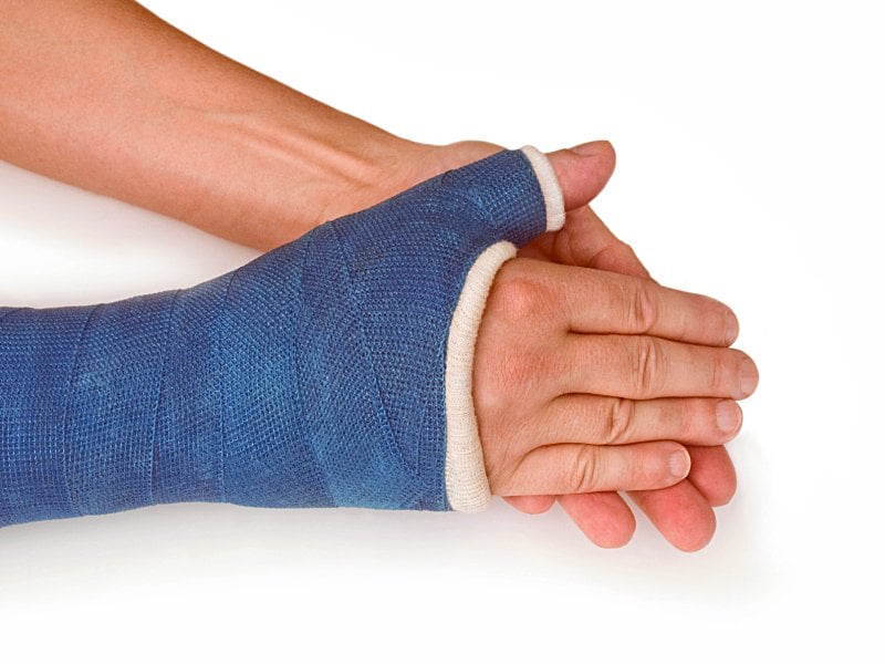 K-Wires Offer No Advantage Over Plaster Casts in Improving Wrist Fracture Outcomes 