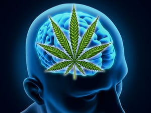 Cannabis Harms Brain, Imaging Shows